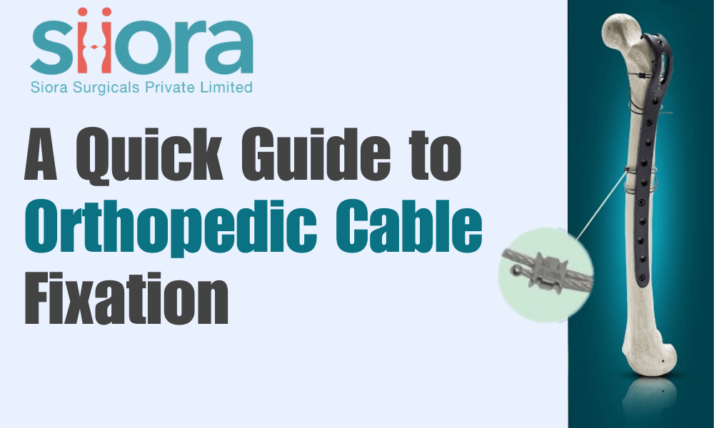 A Quick Guide to Orthopedic Cable Fixation